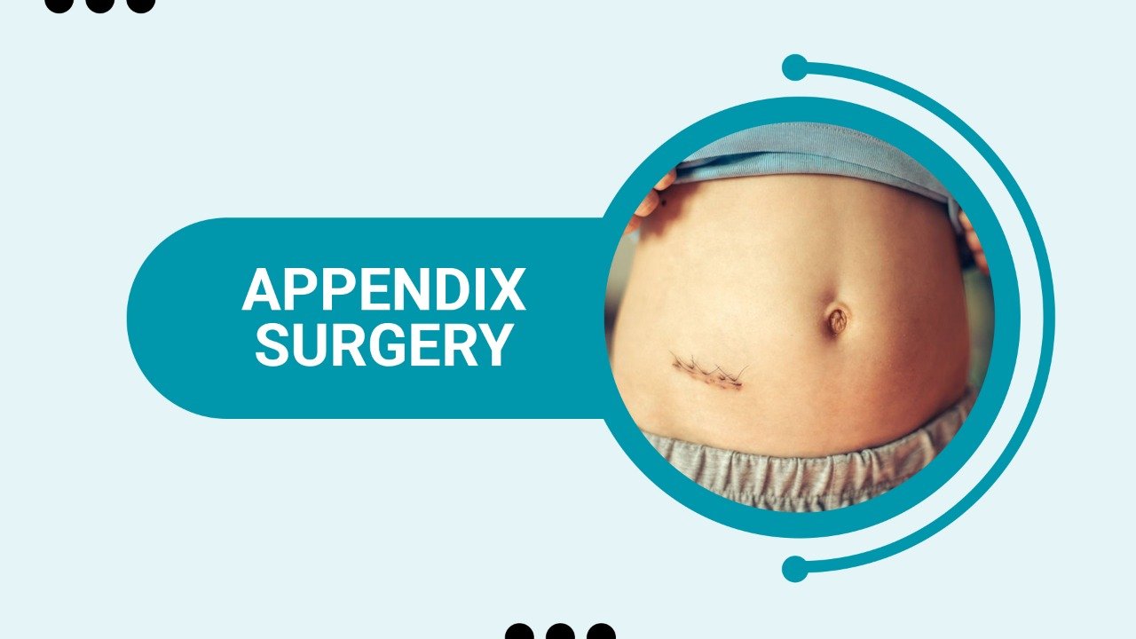 Appendix surgery